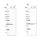 Western blot analysis using Anti-DNAJC9 antibody HPA035215 (A) shows similar pattern to independent antibody HPA035216 (B).