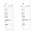 Western blot analysis using Anti-DNAJC9 antibody HPA035215 (A) shows similar pattern to independent antibody HPA035216 (B).
