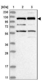 Lane 1: Marker [kDa] 230, 130, 95, 72, 56, 36, 28, 17, 11_br/_Lane 2: Human cell line RT-4_br/_Lane 3: Human cell line U-251MG sp