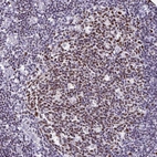 Immunohistochemical staining of human tonsil shows strong nuclear positivity in germinal center cells.