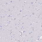 Immunohistochemical staining of human cerebral cortex shows no positivity in neurons as expected.
