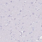 Immunohistochemical staining of human cerebral cortex shows no positivity in neurons as expected.