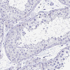 Immunohistochemical staining of human testis shows no positivity in cells in seminiferous ducts as expected.