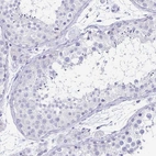 Immunohistochemical staining of human testis shows no positivity in cells in seminiferous ducts as expected.