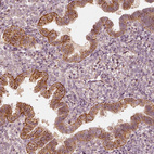 Anti-GORASP2 Antibody