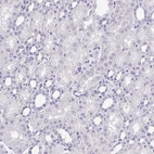 Immunohistochemical staining of human kidney shows no positivity in cells in tubules as expected.