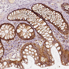 Anti-GORASP2 Antibody