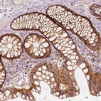 Immunohistochemical staining of human colon shows strong cytoplasmic positivity in glandular cells.