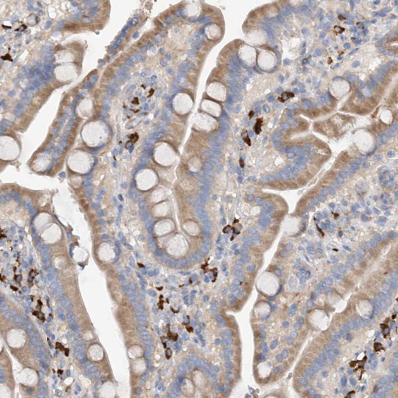 Anti-SLC5A11 Antibody