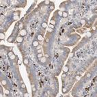 Anti-SLC5A11 Antibody