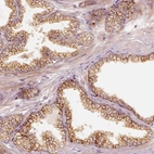 Immunohistochemical staining of human prostate shows strong cytoplasmic positivity in glandular cells.