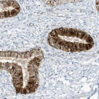 Anti-SCGB1D2 Antibody