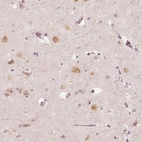 Immunohistochemical staining of human cerebral cortex shows strong cytoplasmic positivity in neurons.
