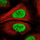 Immunofluorescent staining of human cell line U-2 OS shows localization to nucleoplasm.