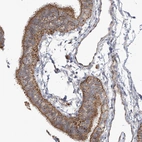 Immunohistochemical staining of human fallopian tube shows moderate granular cytoplasmic positivity in glandular cells.