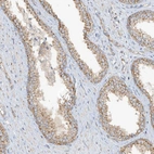 Immunohistochemical staining of human prostate shows weak granular cytoplasmic positivity in glandular cells.