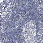 Anti-SCGB1D2 Antibody