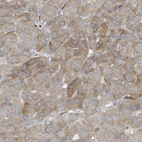 Anti-THNSL2 Antibody