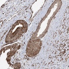 Anti-SOGA3 Antibody