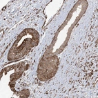 Anti-SOGA3 Antibody