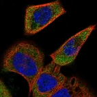 Anti-ACOXL Antibody