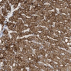 Anti-ERI2 Antibody