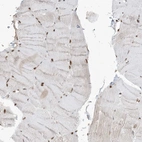 Immunohistochemical staining of human skeletal muscle shows strong nuclear positivity in myocytes.