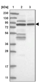 Lane 1: Marker [kDa] 230, 130, 95, 72, 56, 36, 28, 17, 11_br/_Lane 2: Human cell line RT-4_br/_Lane 3: Human cell line U-251MG sp