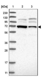 Lane 1: Marker [kDa] 230, 130, 95, 72, 56, 36, 28, 17, 11_br/_Lane 2: Human cell line RT-4_br/_Lane 3: Human cell line U-251MG sp
