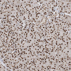 Immunohistochemical staining of human pancreas shows strong nuclear positivity in exocrine glandular cells.