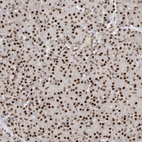 Immunohistochemical staining of human pancreas shows strong nuclear positivity in exocrine glandular cells.
