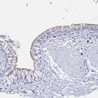 Immunohistochemical staining of human bronchus shows moderate positivity in cilia in glandular cells.