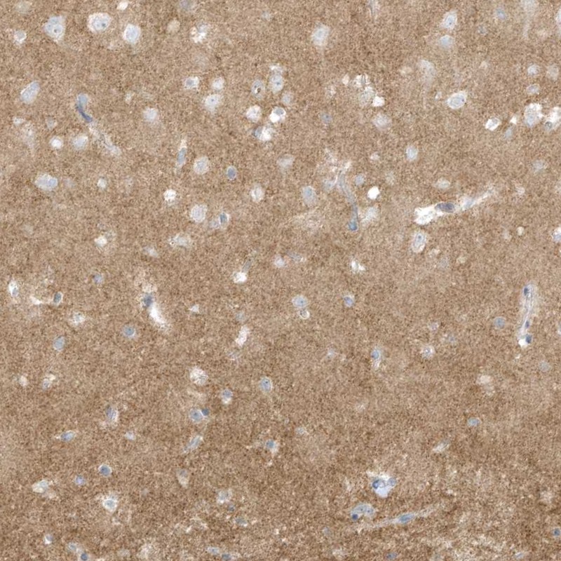 Anti-ARHGEF9 Antibody