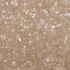 Anti-ARHGEF9 Antibody