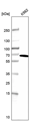 Western blot analysis in human cell line K562.