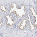 Immunohistochemical staining of human prostate shows weak to moderate cytoplasmic positivity in glandular cells.