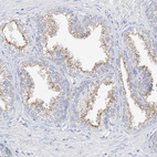 Anti-RASA2 Antibody