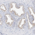 Immunohistochemical staining of human prostate shows weak to moderate cytoplasmic positivity in glandular cells.