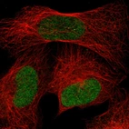 Immunofluorescent staining of human cell line U-2 OS shows localization to nucleoplasm.