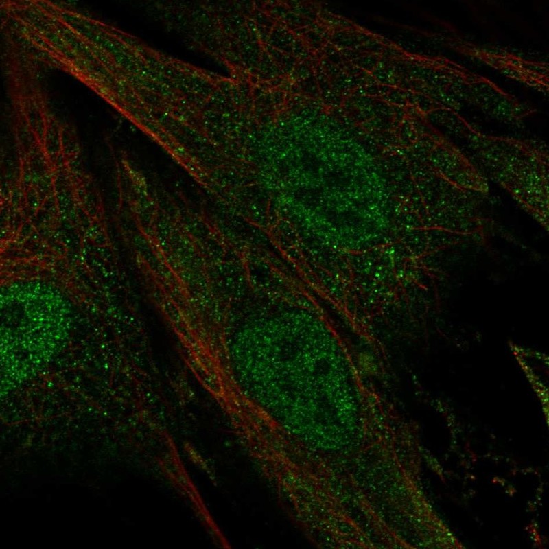 Anti-CERKL Antibody