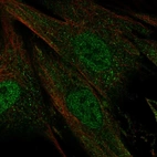 Anti-CERKL Antibody