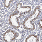 Immunohistochemical staining of human endometrium shows moderate cytoplasmic positivity in glandular cells.