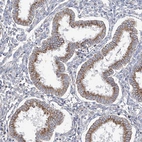 Immunohistochemical staining of human endometrium shows moderate cytoplasmic positivity in glandular cells.