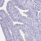 Immunohistochemical staining of human fallopian tube shows moderate positivity in cilia in glandular cells.