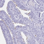 Immunohistochemical staining of human fallopian tube shows moderate positivity in cilia in glandular cells.