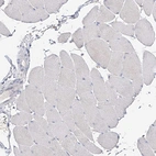 Immunohistochemical staining of human skeletal muscle shows very weak cytoplasmic positivity in monocytes.