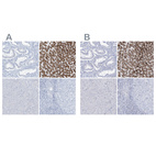 Immunohistochemical staining of human endometrium, liver, pancreas and tonsil using Anti-AGXT antibody HPA035370 (A) shows similar protein distribution across tissues to independent antibody HPA035371 (B).