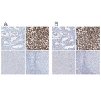 Immunohistochemical staining of human endometrium, liver, pancreas and tonsil using Anti-AGXT antibody HPA035370 (A) shows similar protein distribution across tissues to independent antibody HPA035371 (B).