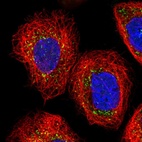 Immunofluorescent staining of human cell line A-431 shows localization to vesicles.