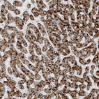 Immunohistochemical staining of human liver shows strong granular positivity in cytoplasm in hepatocytes.